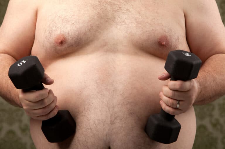 Connection between gynecomastia and overweight