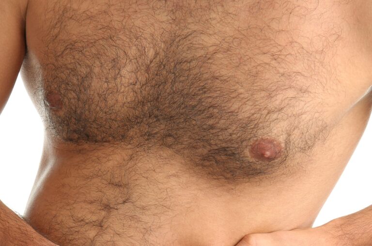 close up of breast gland enlargement
