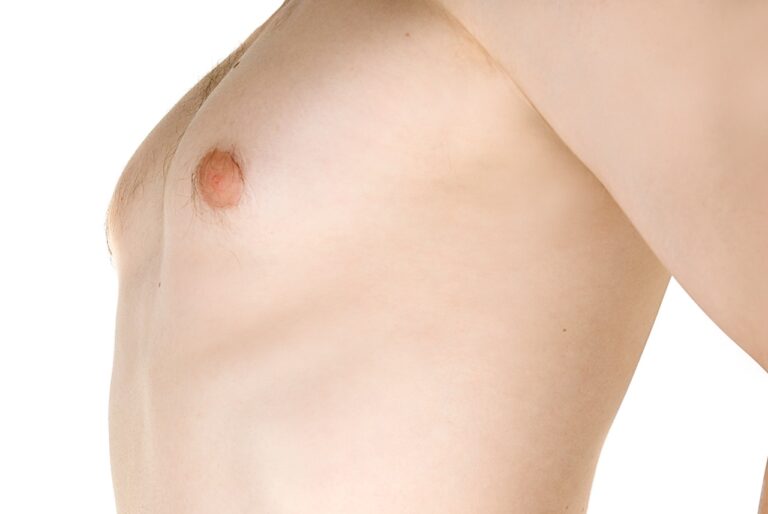 moderate male breast enlargement close up